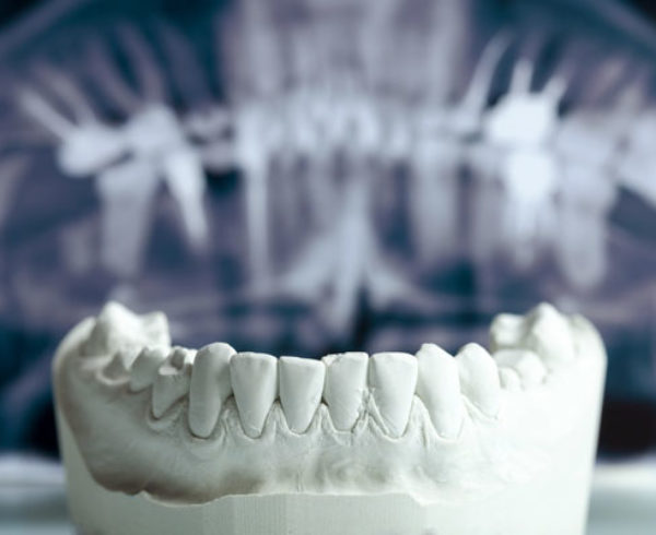 Protesi-Studio Dentistico Bernasconi | Dentista Saronno